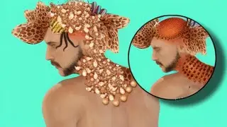 ASMR Remove Maggots & Worm Infected Head | Severely Injured Animation | black heads remove
