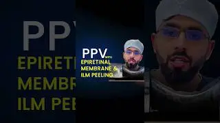 PPV with Epiretinal membrane and ILM peeling