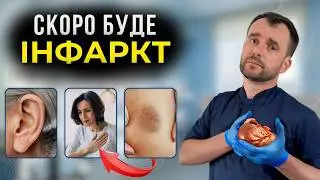 ПЕРШІ ОЗНАКИ ІНФАРКТУ! Ранні симптоми, які ви не помічаєте
