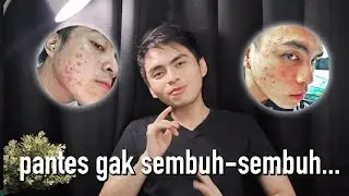 KEBANYAKAN COLI BIKIN JERAWATAN?! - MITOS TENTANG JERAWAT YANG HARUS KAMU TAHU! - PSK EP 5