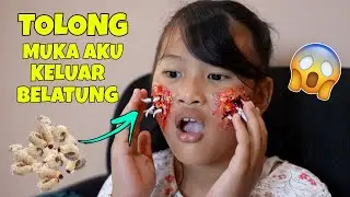 IIIHHH MUKA CHIKA KELUAR BELATUNG | CHIKAKU CHANNEL