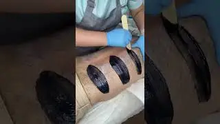 Депиляция мужской спины