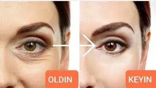 KO'Z OSTI AJINLARIGA QARSHI NIQOBLAR # КУЗ ОСТИ АЖИНЛАРИГА КАРШИ НИКОБЛАР