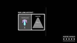 SideLobe Artifact Animation | Austin Visuals
