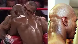 Why Would A Professional Fighter Bite Their Opponent?