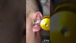 Китайка, льет кипяток в уши