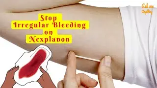 How to Stop Irregular Bleeding on Nexplanon? How to Stop Breakthrough Bleeding on Nexplanon?