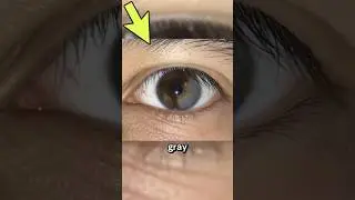 Incredible Rare Photos That Will Leave You Speechless | Part 149