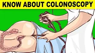 Things You Should Know About Colonoscopy And Colon Health