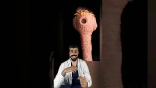 Il verme solitario puo' raggiungere i 9 metri di lunghezza..