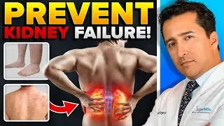 [CLUES] That Your 'Kidneys' Are FAILING Soon!!
