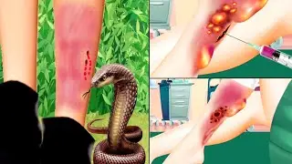ASMR Treatment For Severe Snake Bite | pimples removal | satisfying black head removal | animation