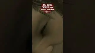 Dung Eater never dies aka face reveal