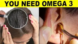 10 Signs Your Body Is Begging For Omega-3