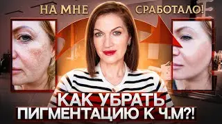 Пигментация. Почему не уходит и как убрать. У меня получилось! ТОП-средств для осветления! 💥💥💥