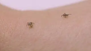 Ticks & Lyme Disease: What to know in 2024