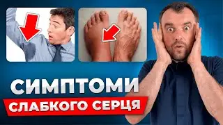 Як запобігти інфаркту! Це перші ознаки проблем з СЕРЦЕМ!