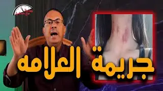 بسبب علامه غريبه زوج يــ ـقــ ـتــ ـل زوجته بطريقه بــ ـشـ ـعــ ـه شك فى سلوكها !!