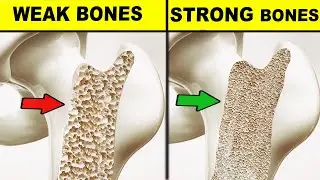 NATURAL Ways To Strengthen Bones (Prevent OSTEOPOROSIS)