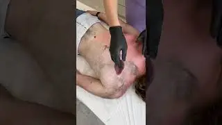 Депиляция мужской спину. Часть 1