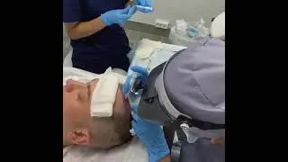 Как проходит операция по пересадке волос в клинике 