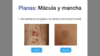 Lesiones primarias y secundarias de la piel