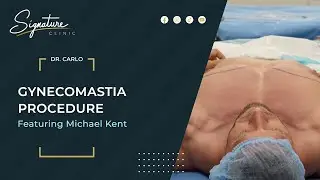 Michael Kent  - Gynecomastia Surgery