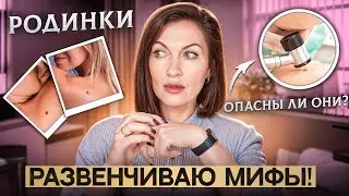 Опасны ли родинки? Развенчиваю мифы! Кто в группе риска и насколько он велик 😎😎😎