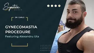Alexandru Uta - Gynecomastia Surgery