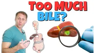 Do I Have Too Much Bile  (Biliary Hyperkinesia)