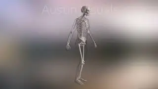 EXCYABIR Hip Brace Medical 3D Animation Produced by Austin Visuals