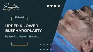 Steven Barrett - Blepharoplasty Procedure