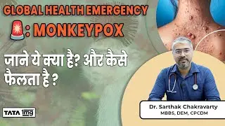 MONKEYPOX जाने ये क्या है? और कैसे फैलता है? | MPOX Virus in India | Causes and Symptoms |Dr Sarthak