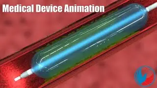 Photonic Catheter 3D Animation | Medical Device Animation