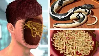 ASMR Remove Mutant Hands,Maggot Larvae  Large Pustules on face | #@RainbowASMRTV