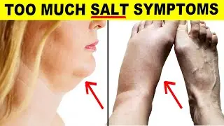 9 Signs You're Eating Too Much Salt