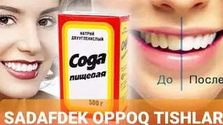 SODA YORDAMIDA TISHLARNI SADAFDEK OPPOQ QILISH🦷