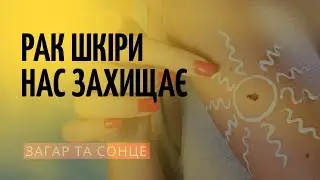 Коли сонце викликає рак шкіри!