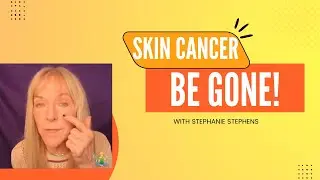 Skin Cancer, Be Gone!