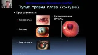 Повреждения глаз часть1
