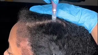 Les cheveux on en parle ? Ils sont important , et nous complexe parfois!