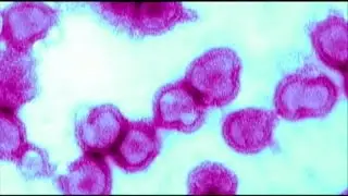 Everything you need to know about the norovirus