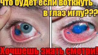Что будет если воткнуть в глаз иглу!?