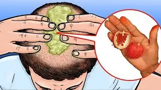 11 Proven Foods To Get Thicker Hair In 7 Days